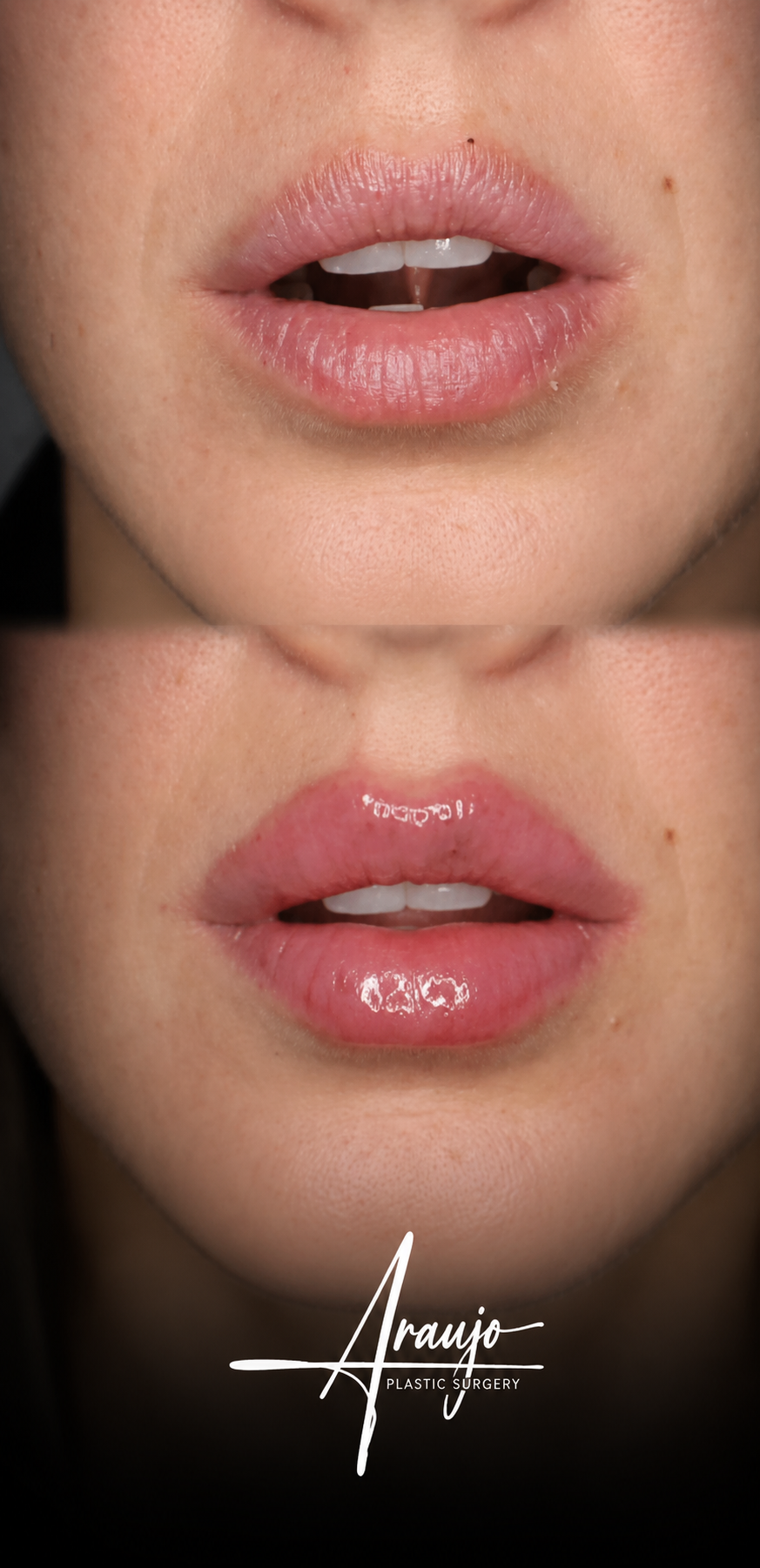 Labios